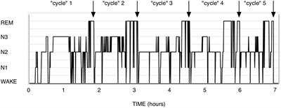 An Asymmetrical Hypothesis for the NREM-REM Sleep Alternation—What Is the NREM-REM Cycle?